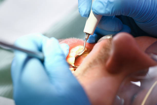 Best Broken Tooth Emergency  in Sheffield, OH