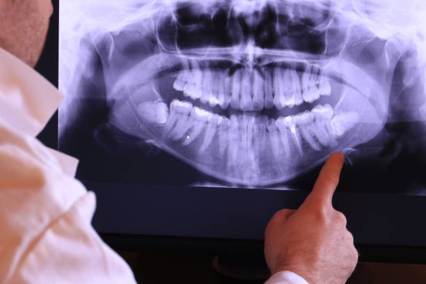 Best Broken Tooth Emergency  in Sheffield, OH